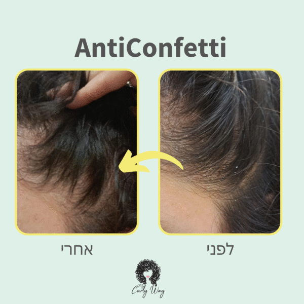 ⁦AntiConfetti שמפו טיפולי נגד קשקשים⁩ – תמונה ⁦4⁩