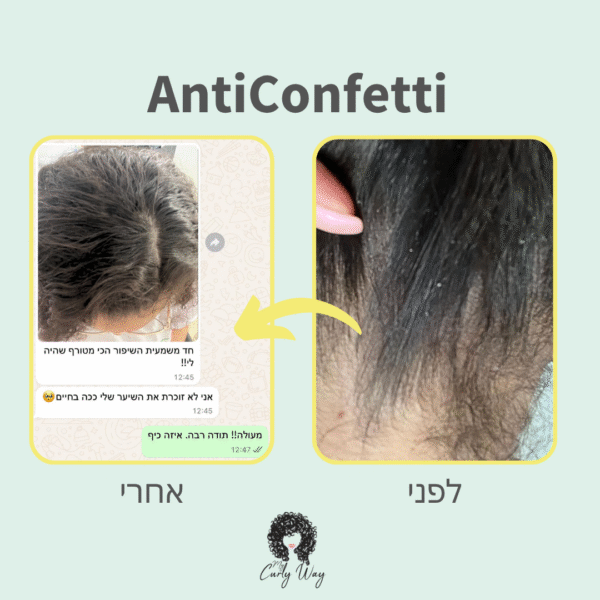⁦AntiConfetti שמפו טיפולי נגד קשקשים⁩ – תמונה ⁦6⁩